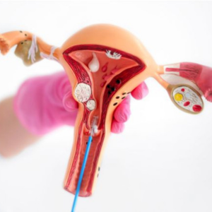 Hysteroscopy